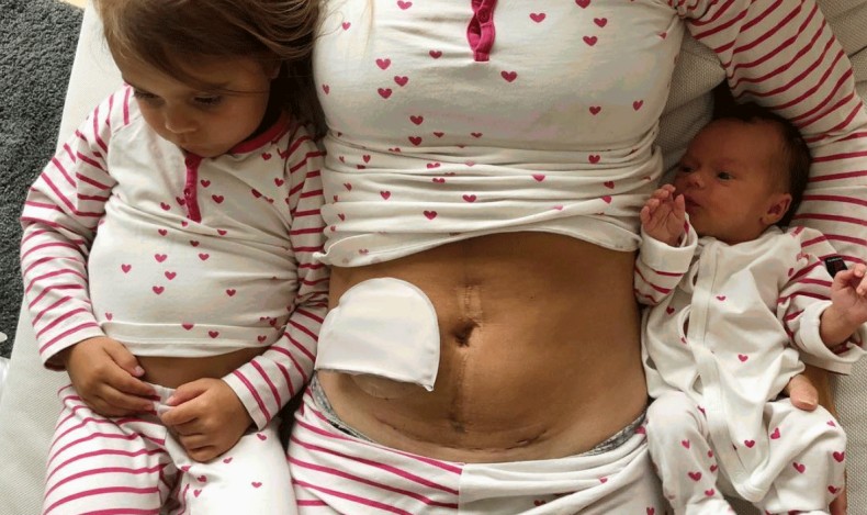 10 IBD-bloggere du bør følge!