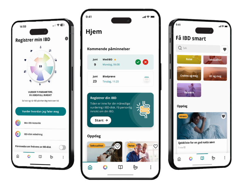 Kjenner du til IBDinfo-appen?